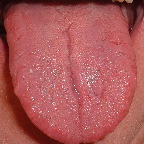 lengua